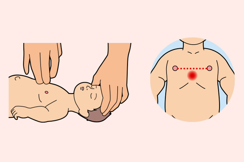 赤ちゃんの胸骨圧迫